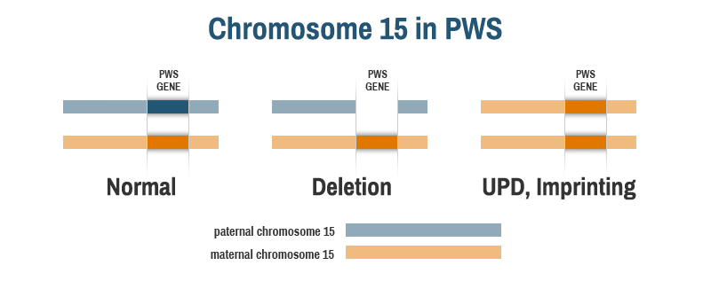 Genetic Therapy for Prader-Willi Syndrome